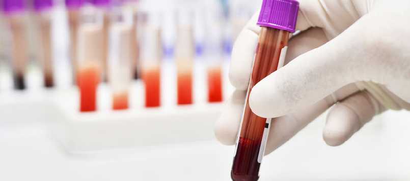 Lucha contra el SIDA