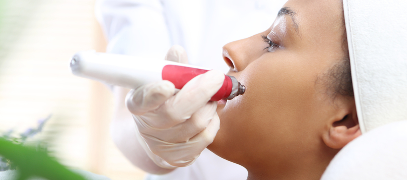 dermapen-y-arrugas-6