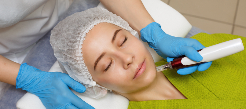 qué-es-el-dermapen-3